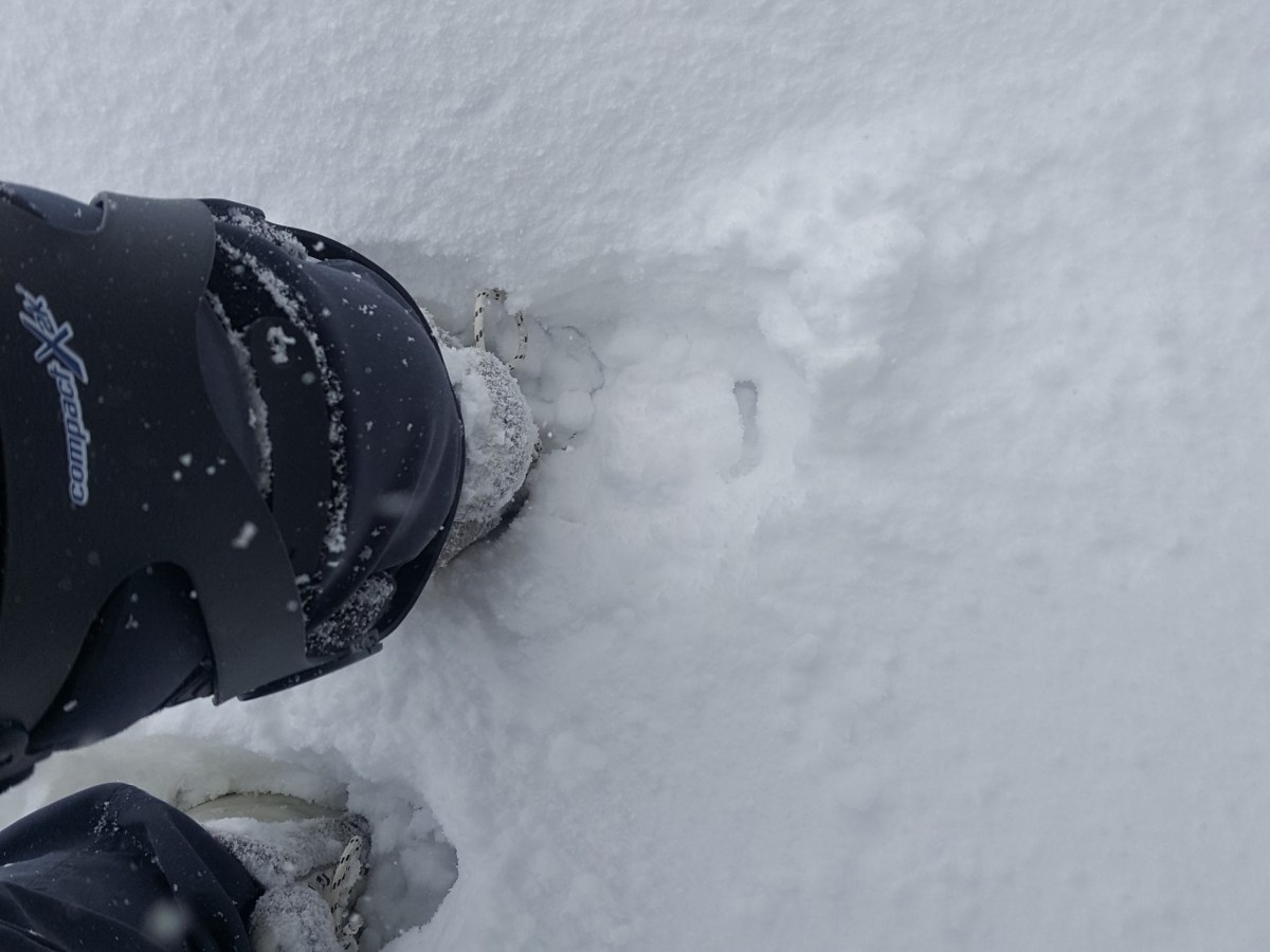 MCL Injury Physiotherapy